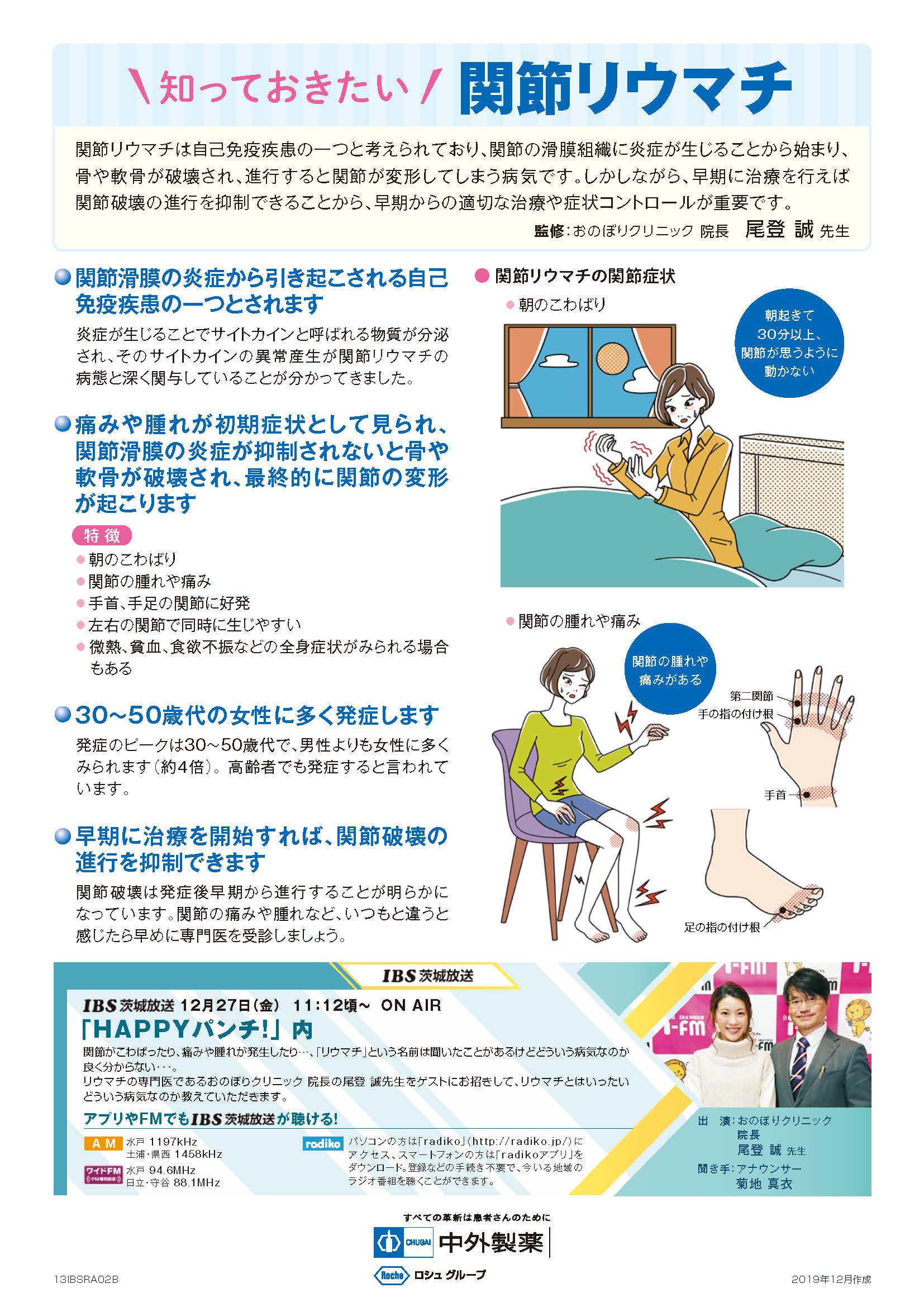 IBS茨城放送 12月27日（金）ON AIR!「知っておきたい 関節リウマチ 